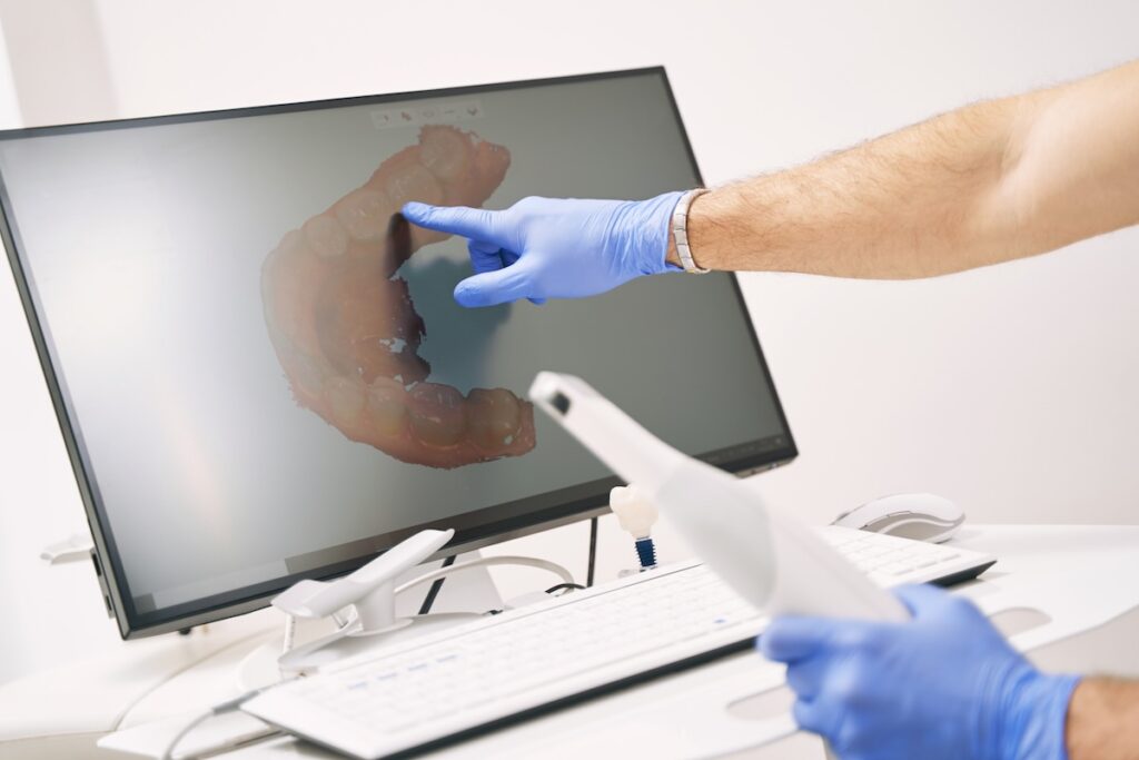 Intra oral scanning magnolia smiles